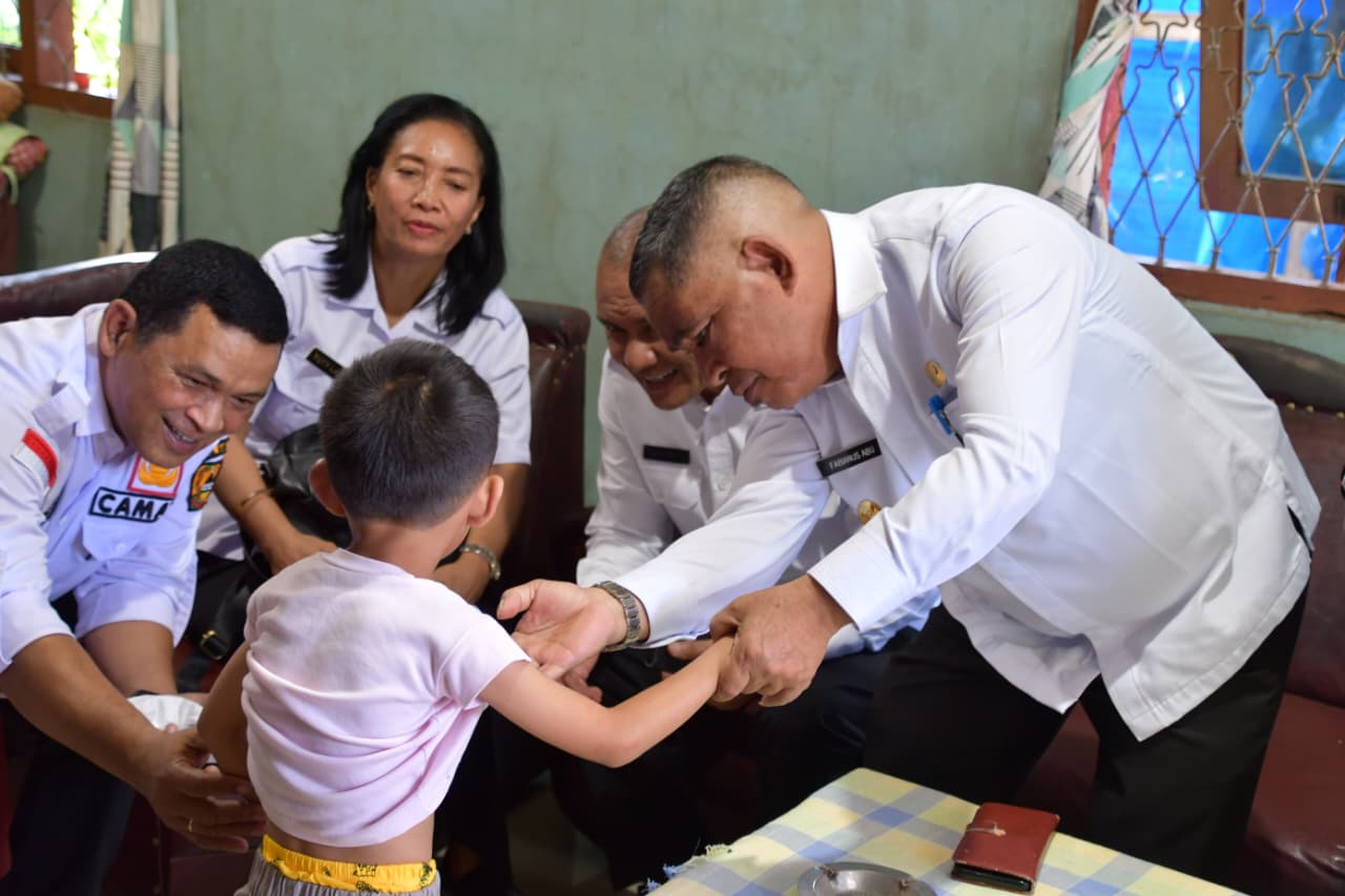 Wakil Bupati Manggarai, Fabianus Abu, S.Pd saat mengunjungi korban gigitan anjing Rabies di Karot Ruteng